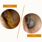 Electric Ear Wax Removal
