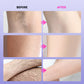 Multi-Use Gentle Effective Hair Removal Cream